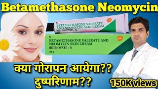 Betnovate N cream  Betamethasone Neomycin cream  betnovate n skin cream [upl. by Nysa]