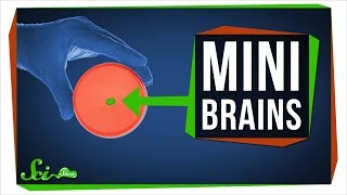 What Growing Mini Brains Has Taught Us And Whats Next [upl. by Nosiaj894]