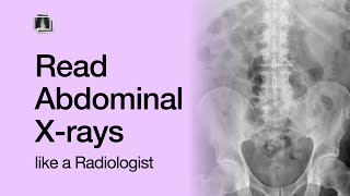 How to Read an Abdominal XRay [upl. by Anana999]