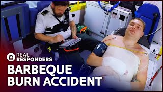 Patient Suffers Burn Injury After BBQ Accident  Inside The Ambulance Marathon  Real Responders [upl. by Niall]