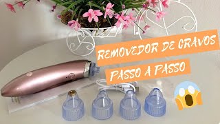 Passo a passo Aprenda remover os cravos com o aparelho à vácuo portátil [upl. by Sandro]