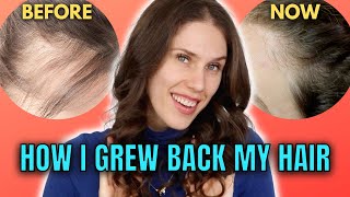 10 Best amp Worst Hair Growth Treatments That I’ve Tried At Home [upl. by Sehguh536]