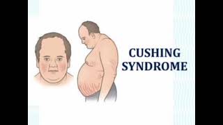 Cushing syndrome mrcpch Video station [upl. by Najar]