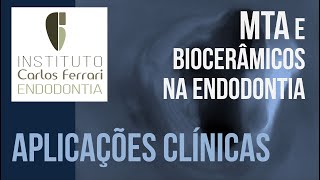 MTA e Biocerâmicos na Endodontia  2a parte Aplicações clínicas [upl. by Brandise]