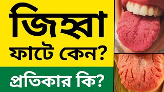 জিহ্বা ফাটে কেন জিহ্বা ফাটার কারণ ও প্রতিকার  Fissured tongue [upl. by Eisso]