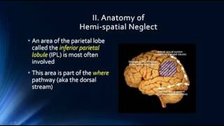 Neurophysiology of Attention Hemispatial Neglect [upl. by Faustus]