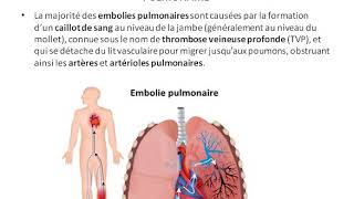 L embolie pulmonaire [upl. by Aisanat226]