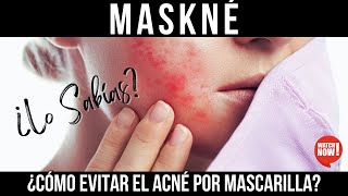 ¿Qué es el Maskné ¡Descubre cómo prevenirlo [upl. by Ymia]