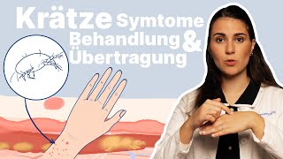 Krätze erkennen amp behandeln Was hilft bei infizierten Möbeln │Dr med Alice Martin [upl. by Blau605]