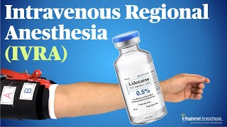 IVRA Intravenous Regional Anesthesia Theory tips and tricks [upl. by Noimad294]