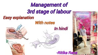 Management of 3rd stage of labour  AMTSLactive management of 3rd stage   expectant management [upl. by Stine]