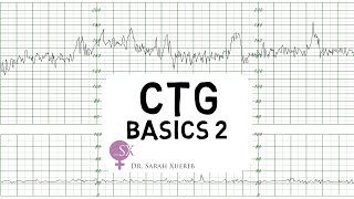 CTG Basics Part 2  Decelerations amp Fetal Physiology [upl. by Jaf]