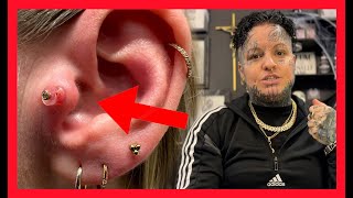 PIERCING BUMP Treatment ⚠️ What is Keloid ⁉️ Everything You Need To Know [upl. by Behl]