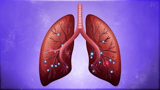 Severe viral lung infections and ARDS causes and effects [upl. by Aihsemat]