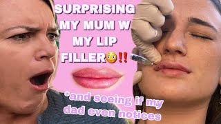 lip filler vlog mums reaction [upl. by Jeb]