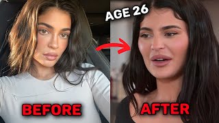 Kylie Jenner Is Now REGRETTING Her Plastic Surgery [upl. by Fradin]