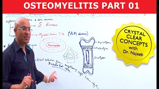 Osteomyelitis  Symptoms amp Causes🩺 [upl. by Montagna548]