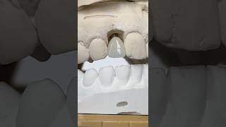 Perfect Lateral Incisor lsk121shorts dentist teeth [upl. by Gabler418]