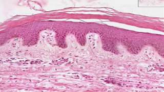 Shotgun Histology Thin Skin [upl. by Nwahsit801]