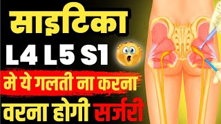 स्पाइन सर्जरी से कैसे बचेंL4 L5 Disc Bulge Treatment Without SurgeryDisc Bulge Treatment In Hindi [upl. by Ecnaralc]