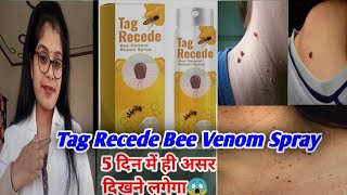 Flysmus Tag Recede Bee Venom Treatment Spray Honest Review  Bee venom treatment spray uses hindi [upl. by Tonnie]