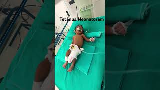 Tetanus in newborn is a fatal disease Tetanus neonatology [upl. by Tati]