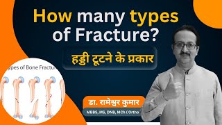 Common types of Bone fracture  Types of Fracture  How many types of Fracture fracture [upl. by Eiten]