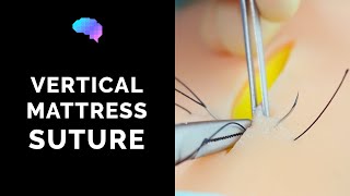 Vertical Mattress Suture  OSCE Guide  UKMLA  CPSA [upl. by Mcspadden]