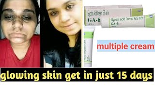 glycol 6 cream for CLEAR SKIN glyco 6 cream kese use kareGA6 pigmentation black spot  benefits [upl. by Akemrehs630]