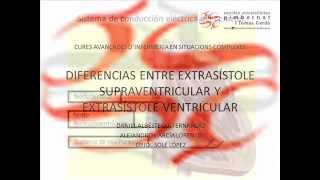 Extrasístole diferencias entre supraventricular y ventricular [upl. by Hudgens811]