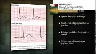 Clinical Electrocardiography A Simplified Approach 8th Edition [upl. by Panta106]