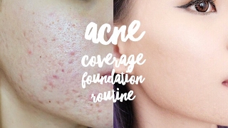 UPDATED ACNE FULL COVERAGE FOUNDATION ROUTINE  VERONICA ONG [upl. by Yetnruoc351]