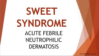 DERMATOLOGY LECTURES SWEETS SYNDROME II ACUTE FEBRILE NEUTROPHILIC DERMATOSIS II SUBTYPES [upl. by Ekal]