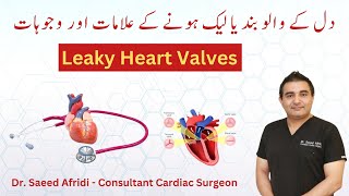 Leaky Heart Valves  Causes and Symptoms  HindiUrdu [upl. by Enneirdna]