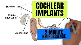 2Minute Neuroscience Cochlear Implants [upl. by Christian165]