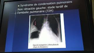 Sémiologie cardiaque et respiratoire  révision 1 cas cliniques examen [upl. by Lam]