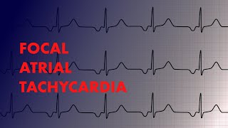 Focal Atrial Tachycardia  EKG Interpretation  MEDZCOOL [upl. by Zachary296]