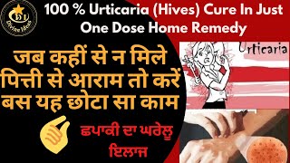 Urticaria Home Remedyशीतपित्त पित्ती का अचूक इलाजਛਪਾਕੀ ਦਾ ਇਲਾਜUrticaria Treatment at home👍 [upl. by Girhiny]