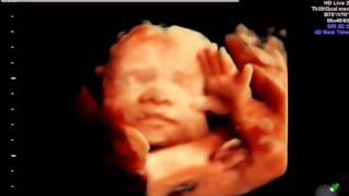 HDlive Ultrasound at 28 weeks Baby yawns and waves [upl. by Alohs]