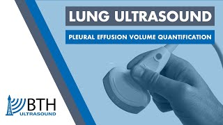 BTH Ultrasound  Lung Ultrasound Pleural Effusion Volume Quantification [upl. by Llirred]