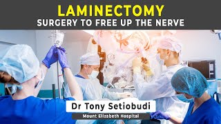 LAMINECTOMY  SURGERY FOR SPINAL STENOSIS [upl. by Aneekahs]