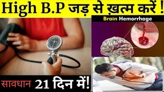 ब्लड प्रेशर  ब्लड प्रेशर कम करने का तरीका  ब्लड प्रेशर के लक्षण  blood pressure  high bp ka ilaj [upl. by Eybbob900]