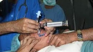 Intubation Video [upl. by Yahsram]