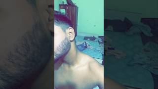 3 Months Consistency result minoxidil shortsvideo [upl. by Cannice]