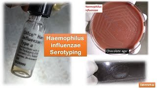 Haemophilus influenzae Colony Morphology Growth around XV factors and serotyping [upl. by Darooge647]