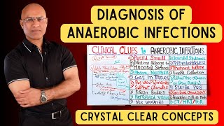 Diagnosis of Anaerobic Infections  Clinical Clues [upl. by Evslin102]