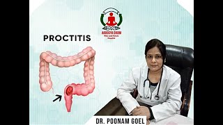 PROCTITISDR POONAM GOEL DR RAJAN GOEL AAROGYADHAM PILES N FISTULA HOSPITAL PANCHKULA [upl. by Nyrraf975]