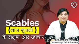 Scabies Treatment Causes Symptoms In Hindi  स्केबीज़ का इलाज कारण लक्षण  Dadu Medical Centre [upl. by Salhcin688]