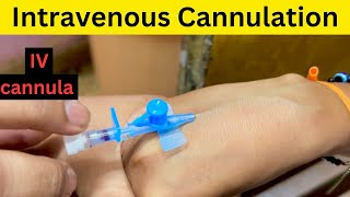 IV Cannulation  Intravenous Cannulation  Learn To Inject Cannula for vein  cannulation [upl. by Cruz]