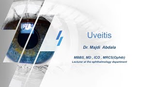 uveitis 1IridocyclitisAntUvitis [upl. by Aihsetel611]